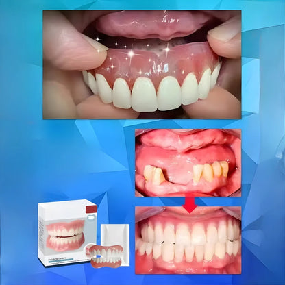 Denture Set Moldable Removable Upper & Lower