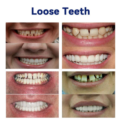 Dentures Flexible Full or Partial Fit Natural-Looking