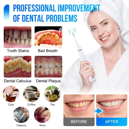Tooth Cleaner Ultrasonic Waterproof 5 Power Levels